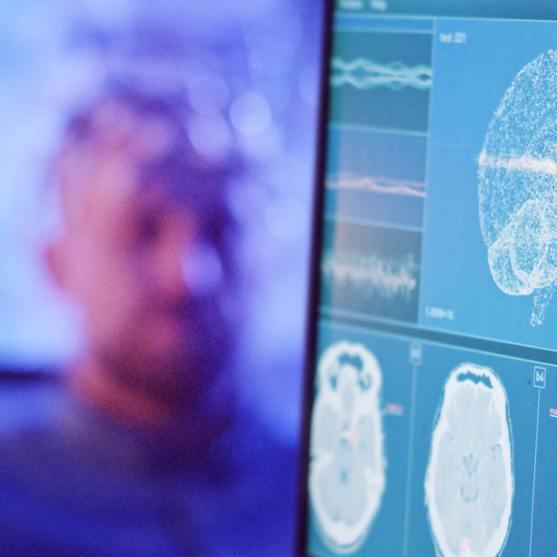 MEDISinn Angebot Gehirnaktivitätscheck Mann mit Elektroden am Kopf während Computer Gehirnaktivität misst.